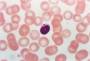 Slika 5: Mikronukleus v limfocitu loveke krvi; poveava na negativu Leica formata 24x36 mm 1000-krat.
